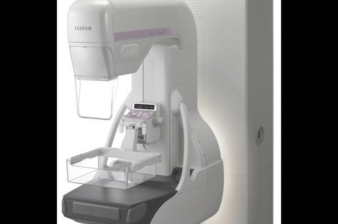 In arrivo i nuovi mammografi digitali